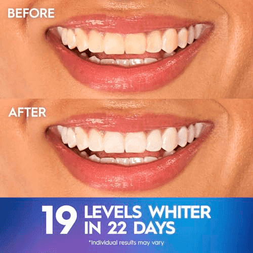 Crest 3D Whitestrips Professional Effects - 22 Treatments image 4
